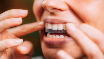 Wer Bleaching-Produkte zuhause verwendet, sollte sich unbedingt an die Angaben des Herstellers halten – und nicht zu viel Effekt erwarten.