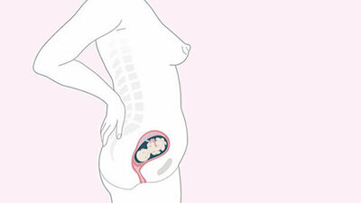 Schwangerschaftskalender SSW 17
