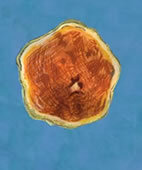 Zeichnung eines Mumps-Virus