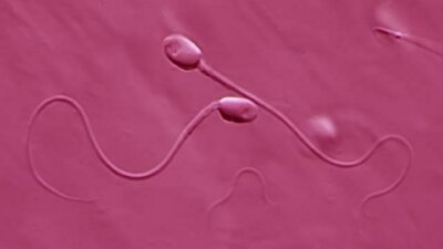 Spermien unter Mikroskop