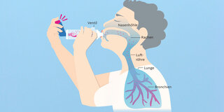 Tief einatmen: Dank Spacer gelangen die Wirkstoffe des Asthmasprays leichter in die Brochnchien, um dort ihre Wirkung zu entfalten.