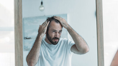 Männer sind im Schnitt häufiger von Haarausfall betroffen als Frauen. Erste Anzeichen sind meist Geheimratsecken.