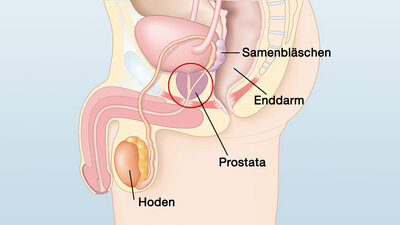 Prostata und umliegende Organe (Schematische Darstellung)