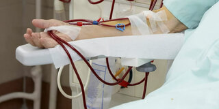 Dialyse   