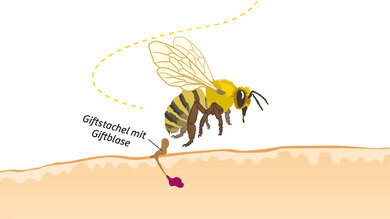 Bienen stechen nur einmal - ihr Stachel bleibt in der Haut stecken.