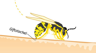 Die Wespe sticht mit ihrem Giftstachel in die Haut.
