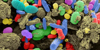 Unser Darm wird von Billionen von Bakterien, Viren und Pilzen besiedelt. Das sogenannte Mikrobiom.