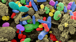 Unser Darm wird von Billionen von Bakterien, Viren und Pilzen besiedelt. Das sogenannte Mikrobiom.