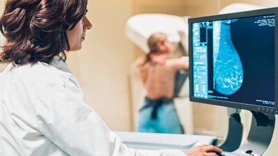 Eine regelmäßige Mammographie wird Frauen ab 50 Jahren empfohlen um Brustkrebs im Frühstadium zu erkennen. 