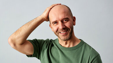 Manche Männer mit anlagebedingtem Haarausfall entscheiden sich für die Glatze.