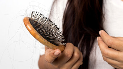 Sammeln sich in der Bürste mehr Haare, als man es gewohnt ist, kann diffuser Haarausfall dahinterstecken. 