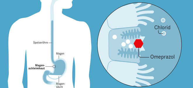 Omeprazol blockiert die Protonen- pumpe. Die Wasserstoffteilchen gelangen nicht mehr in den Magen zum Chlorid. Jedoch passiert das nicht in allen Belegzellen der Magenschleimhaut. Das bedeutet: Es wird noch Magensäure produziert, aber weniger als zuvor. Dadurch ist es im Magen weniger sauer und die Magenschleimhautzellen können ihre schützende Schleimschicht wieder aufbauen.