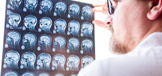 Arzt schaut auf MRT vom Gehirn