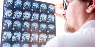 Arzt schaut auf MRT vom Gehirn