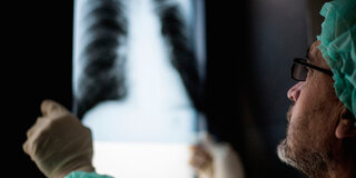 Ein Arzt betrachtet das Röntgenbild einer Lunge.