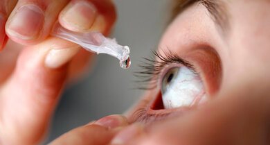 Wichtig bei Glaukom: Augentropfen regelmäßig nach Verordnung anwenden