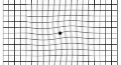Amsler-Gitterlinien-Test: Erscheinen die Linien zum Beispiel verzerrt wie hier dargestellt, weist das auf eine Erkrankung der Makula hin.