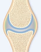 Gesundes Gelenk: Eine glatte Knorpelschicht (blau) schützt die Knochen