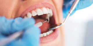 Mit Spiegel und Sonde in der Hand werden Zähne untersucht