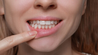 Frau zeigt mit Finger auf gerötetes Zahnfleisch