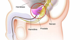 Prostata (Schematische Darstellung)