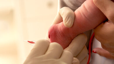 Mit dem beim Neugeborenen-Screening gewonnen Blut wird auch ein Test auf Mukoviszidose gemacht