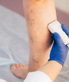 Untersuchung der Gefäße am Bein mit Ultraschall