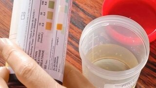 Farblos urin klar Wieso ist