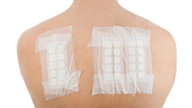 Bei einem Patch-Test werden eine Reihe von Teststoffen in Form von Salben oder Lösungen auf die Rückenhaut aufgetragen