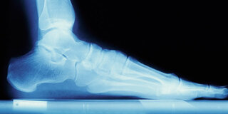 Röntgenaufnahme vom Fuß