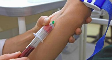 Besteht der Verdacht auf eine CLL, nimmt der Arzt zunächst Blut ab