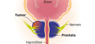 investigatii medicale prostata