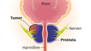 Orgasmus prostata Weibliche Prostata: