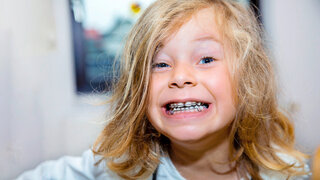 Ein Kind mit einer herausnehmbaren Zahnspange im Mund und unordentlichen Haaren lächelt in die Kamera.