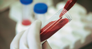 Bluttests geben Aufschluss darüber, ob der Körper Kontakt zu dem Virus hatte