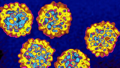 Mikroaufnahme Hepatitis C Virus