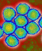 Das Hepatitis C-Virus kann Leberentzündungen hervorrufen