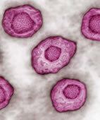 Epstein-Barr-Virus: Eine Infektion damit kann das Risiko für einen Morbus Hodgkin erhöhen