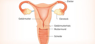 Gebärmutterhals knubbel am Gebärmutterhalskrebs: Symptome,