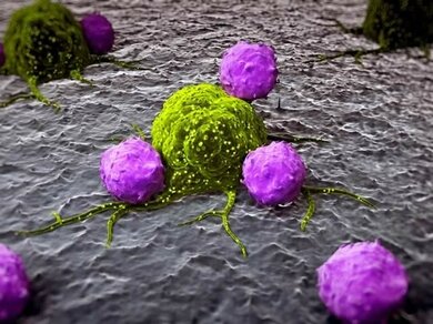 Die körpereigenen weißen Blutkörperchen greifen eine Krebszelle (grün) an