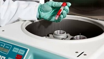Eine Laborantin stellen ein Fläschchen Blut in eine Zentrifuge