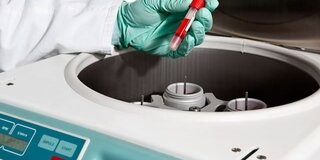 Eine Laborantin stellen ein Fläschchen Blut in eine Zentrifuge