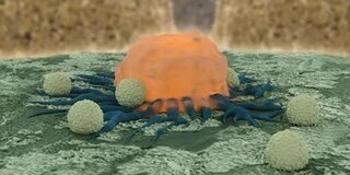Krebszelle mit Lymphozyten