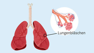 Die Lungenbläschen sind die kleinsten Verästelungen der Atemwege in der Lunge. Sie sind von Blutgefäßen umgeben und der Ort, an dem der Gasaustausch stattfindet.