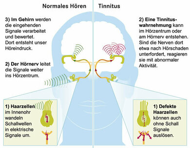 Normales Hören und Wahrnehmung von Tinnitus  (hier: bei Gehörschaden)