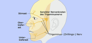Trigeminusnerv (Schematische Darstellung)