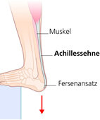 Stärkt die Achillessehne: Auf der Treppenkante mit beiden Füßen behutsam hoch- und runterwippen (am Geländer festhalten), später auf einem Fuß