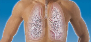 Mann mit Lungenemphysem