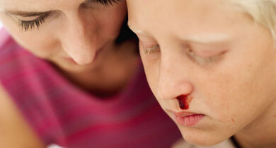Beruhigen Sie Ihr Kind: Nasenbluten ist meistens harmlos und vergeht wieder