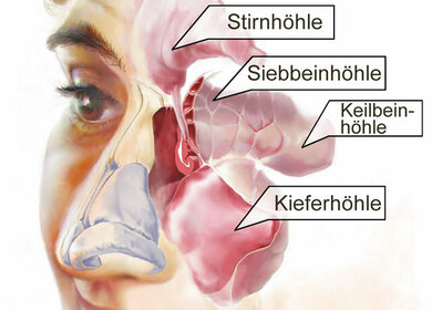 Die Nase und ihre Nebenhöhlen (schematisch)